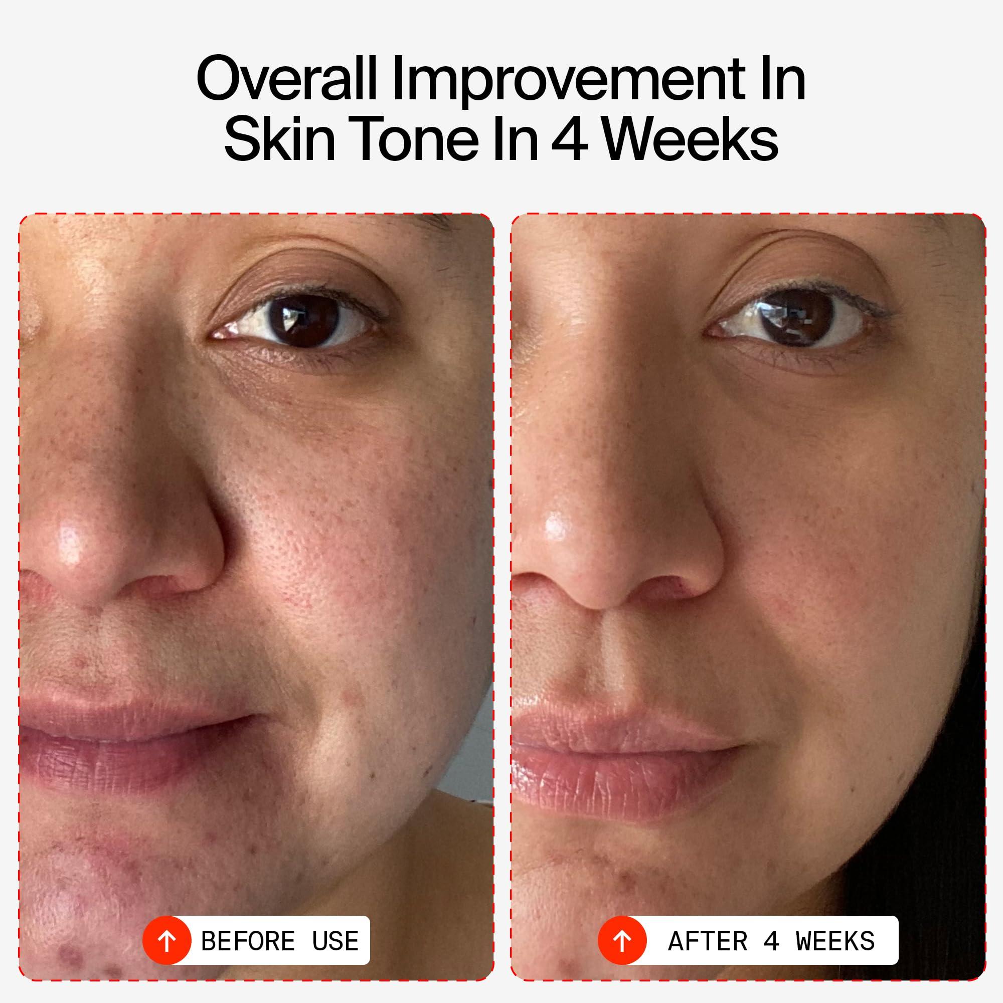 Youth To The People Youth To The People 15% Vitamin C + Caffeine Energy Face Serum, Full Size (1 fl oz), Reduce Puffiness, Brighten Uneven Skin Tone + Improve Texture, Treats Dark Spots + Dullness, Vegan