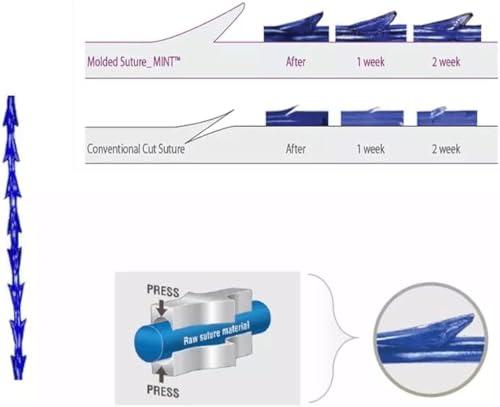 MatYas Pdo Pcl Fishbone Threads, Cog Threads 18G100mm, Barb Threads, W-Type Blunt, Lifting and Firming Anti-Aging, 20Pcs (PDO)