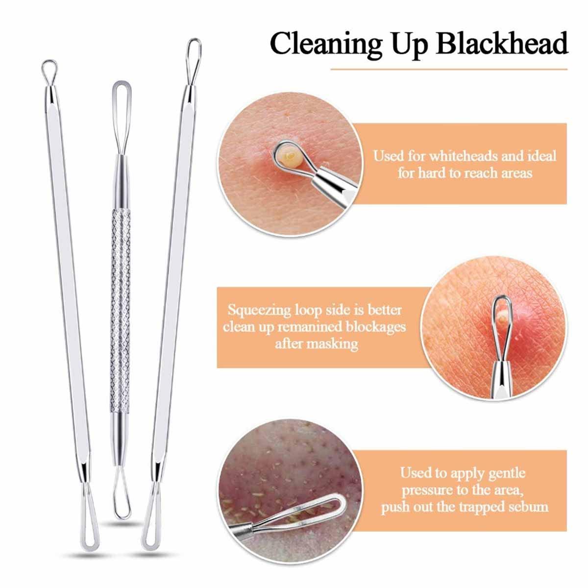 Eztronics Corp Blackhead Remover Pimple Popper Tool Kit - (9 Piece Kit) - Professional Stainless Pimples Comedone Extractor Removal Tool