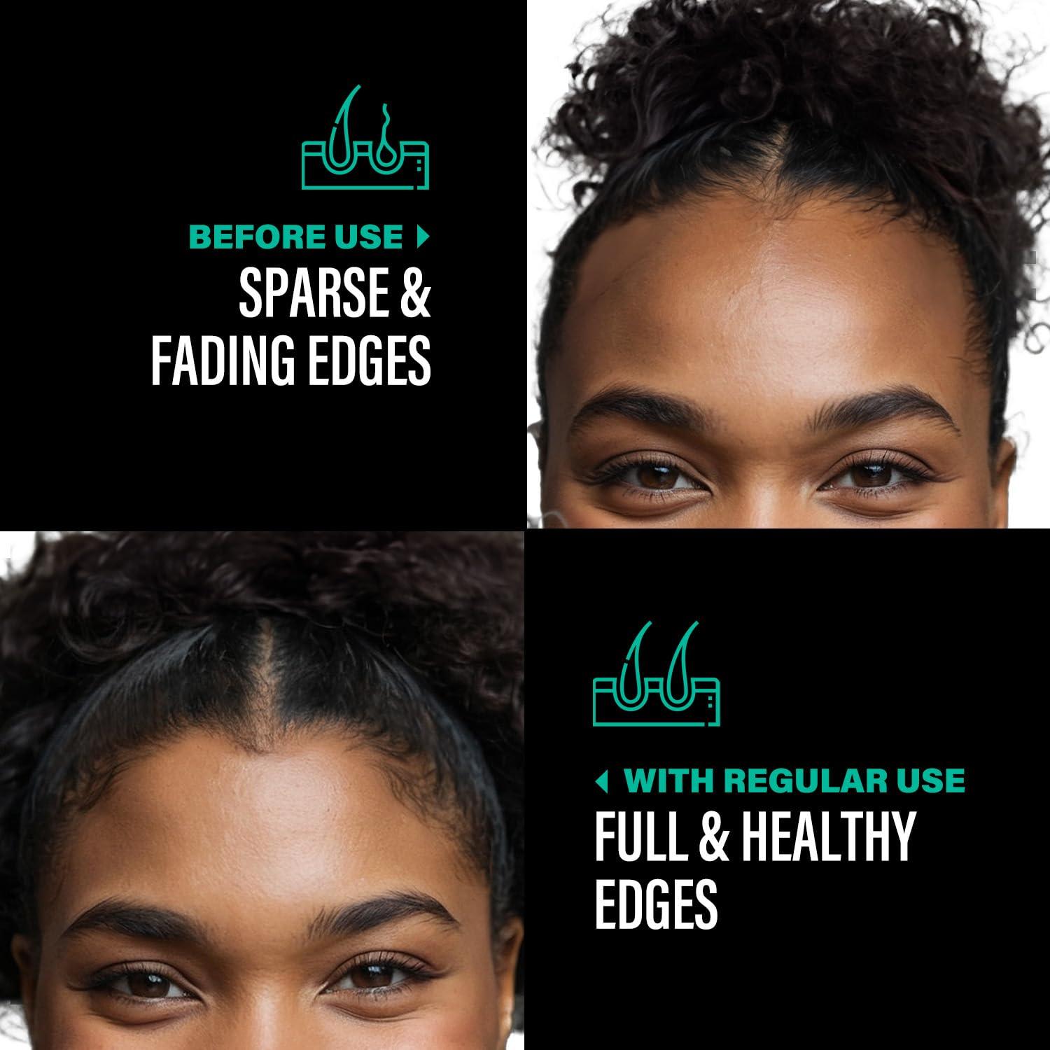 The-Mix-Up Unrefined Batana Oil for Hair Growth - Authentic & Organic Dr Sebi Batana Hair Mask from Honduras - Natural Hair Growth Oil - 4 Ounce Jar