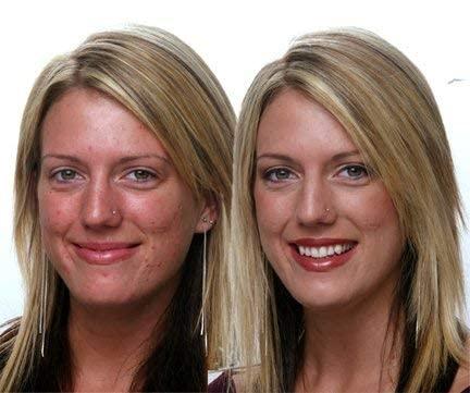 Dermacia Dermacia PRO Breathable Foundation (Creme), Dr. Recommended, Hypoallergenic, Long Lasting, Lightweight, Professional Oxygenating Makeup, Best for Sensitive Skin, Acne & Rosacea, Made in USA