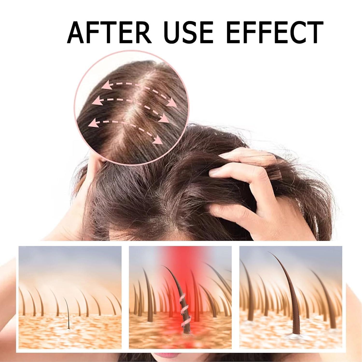 Ginaday 2 Box Ginger Plant Extract Shampoo for Hair Growth and Anti-Loss Control, Hair Growth Oil Care by Ginaday