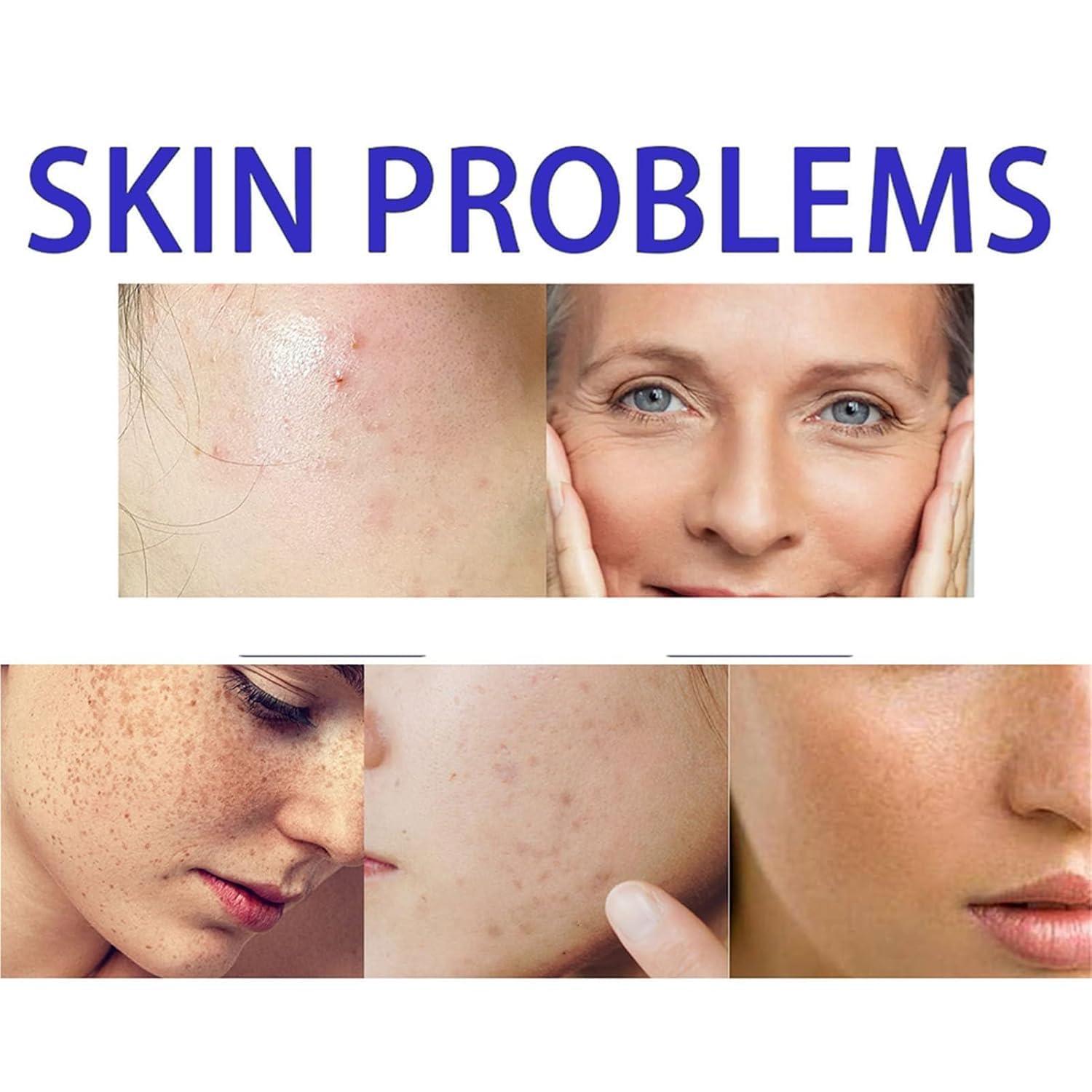 getuse Lion Pair Acne Cream, 20g | Natural Acne Gel for Face | Japanese Moisturizing Treatment for Women & Men | 3pcs (1pc)