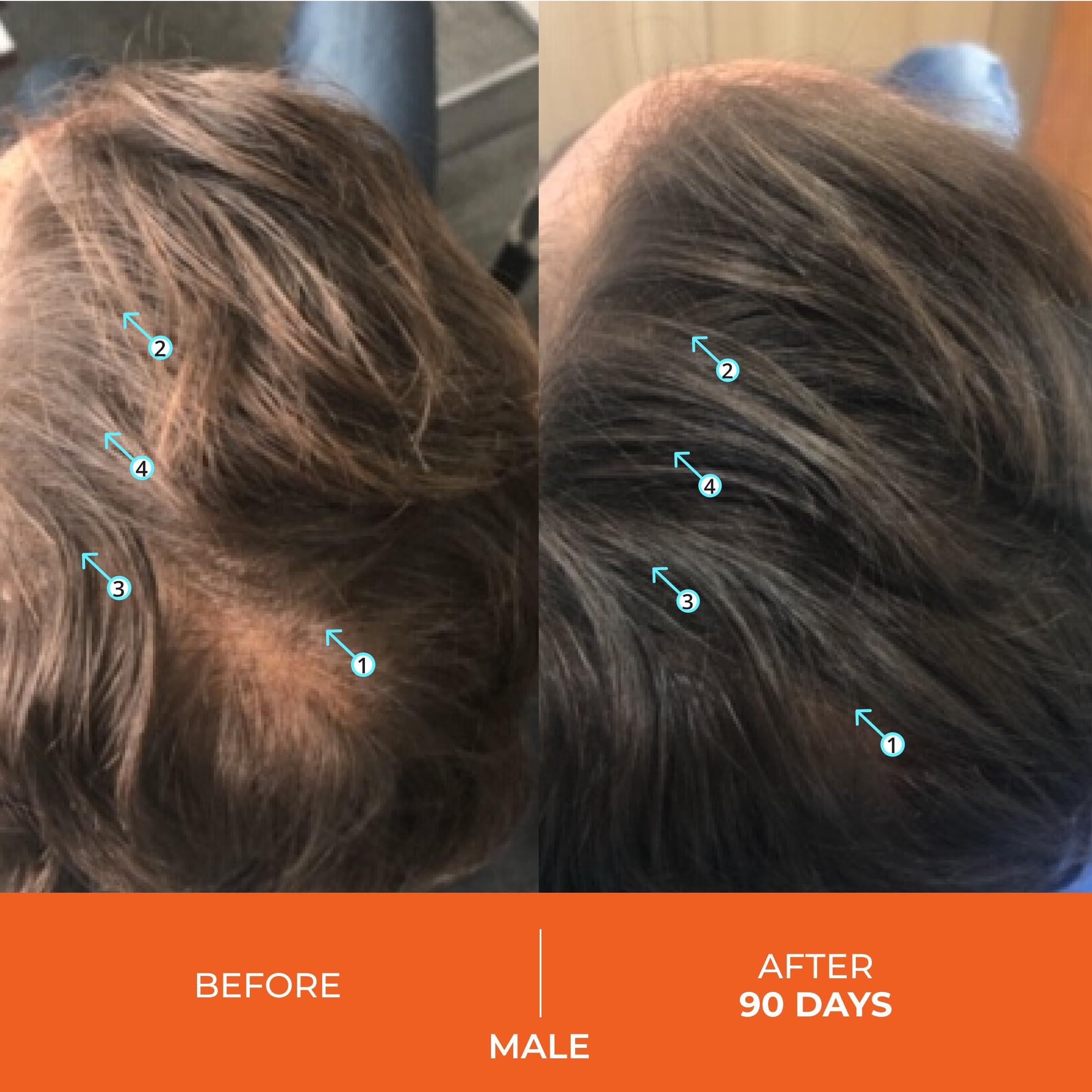 DS LABORATORIES DS Laboratories Revita Shampoo and Conditioner Set, Hair Thickening Shampoo and Conditioner to Support Hair Growth, Sulfate Free Shampoo and Conditioner with Biotin, Caffeine & DHT Blocker, Hair Care