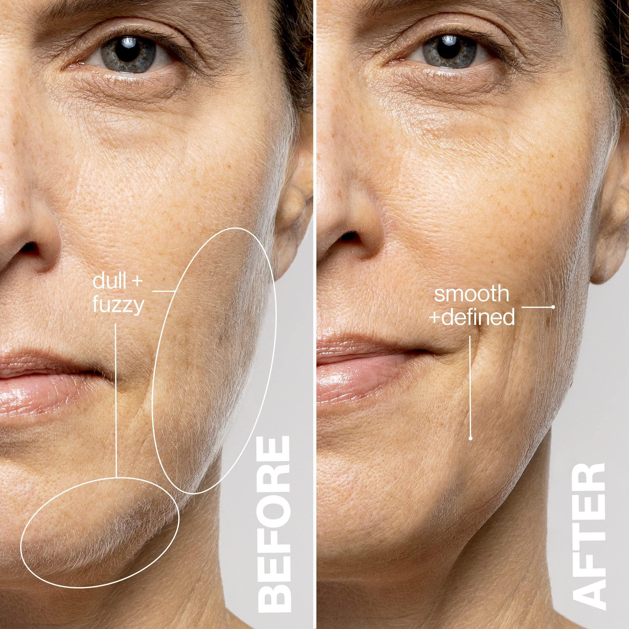 DERMAFLASH DERMAFLASH LUXE+ Sonic Dermaplaning Tool for Face Peach Fuzz Removal, Anti-Aging & Exfoliation, Seafoam