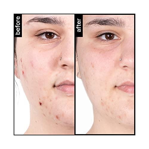 pH-In pH-In The Cleanser