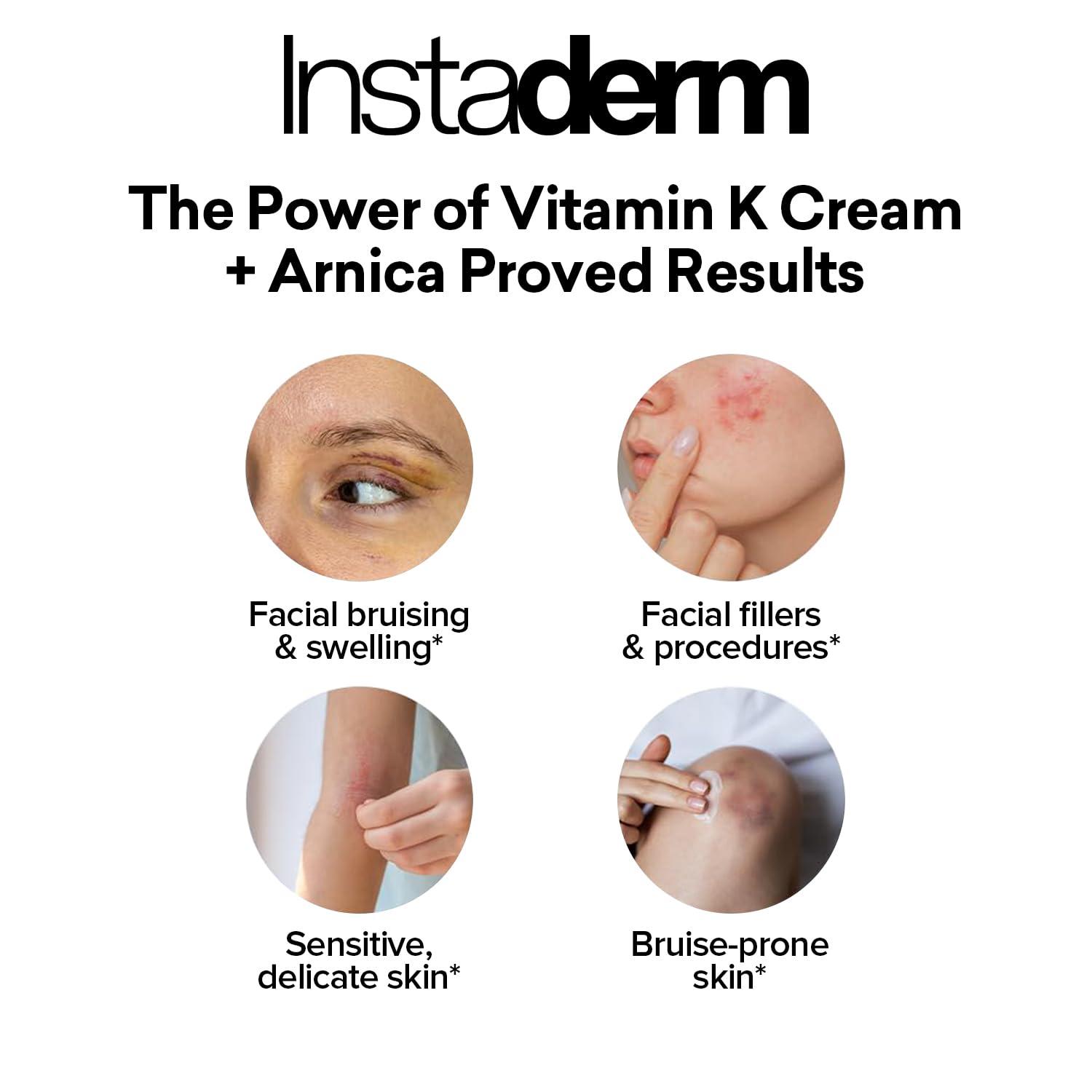 Instaderm Instaderm Vitamin K Cream- Bruise Healing Formula with Arnica. Dark Spot Moisturizer for Bruising, Spider Veins & Broken Capillaries. Repair Under Eye Dark Circles, & Puffiness.