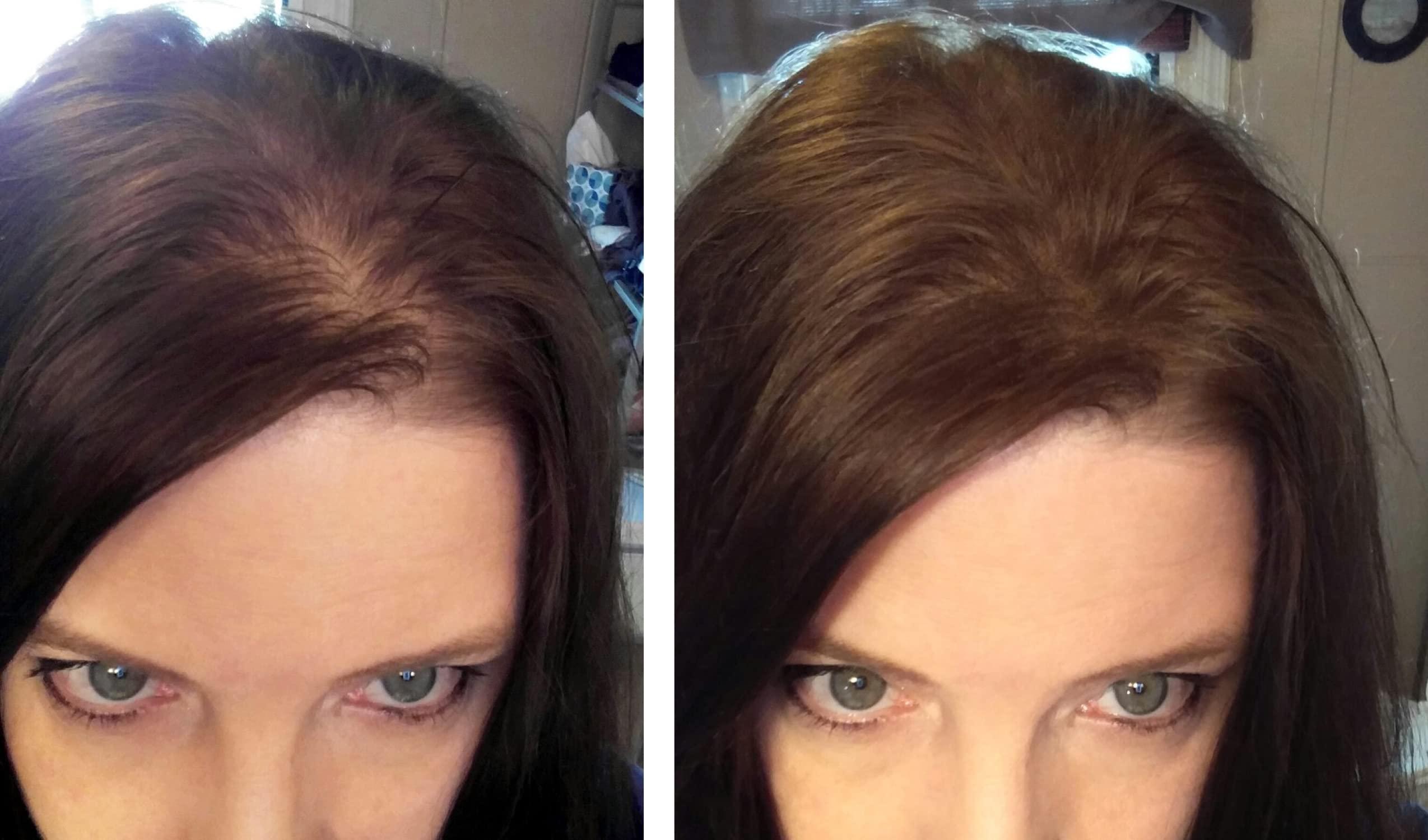 Caboki Caboki Hair Loss Concealer (All-Natural Hair Building Fibers) Travel Size (Medium Brown)