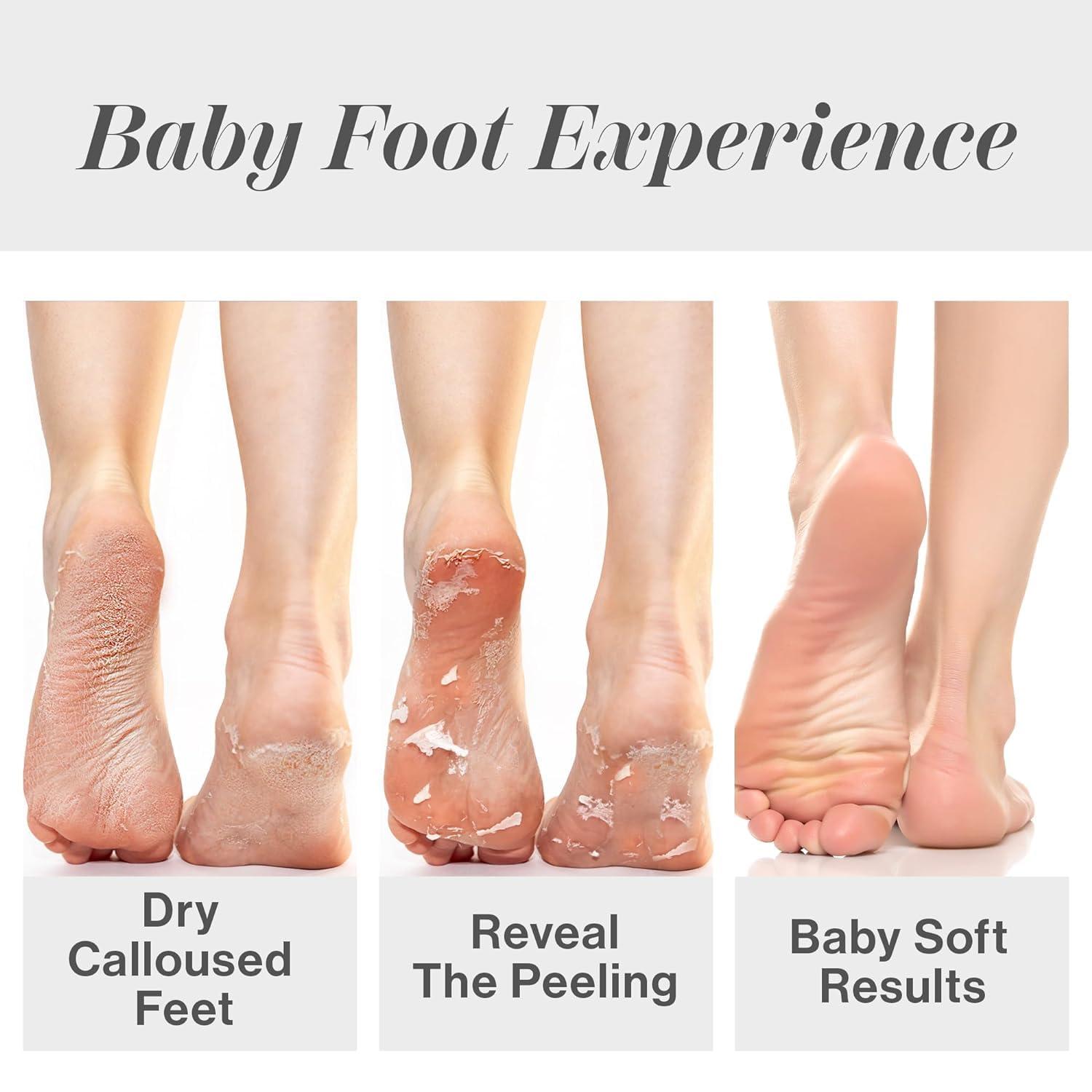 Baby Foot Baby Foot 2 PACK ORIGINAL FOOT PEEL - 2 TREATMENTS INCLUDED
