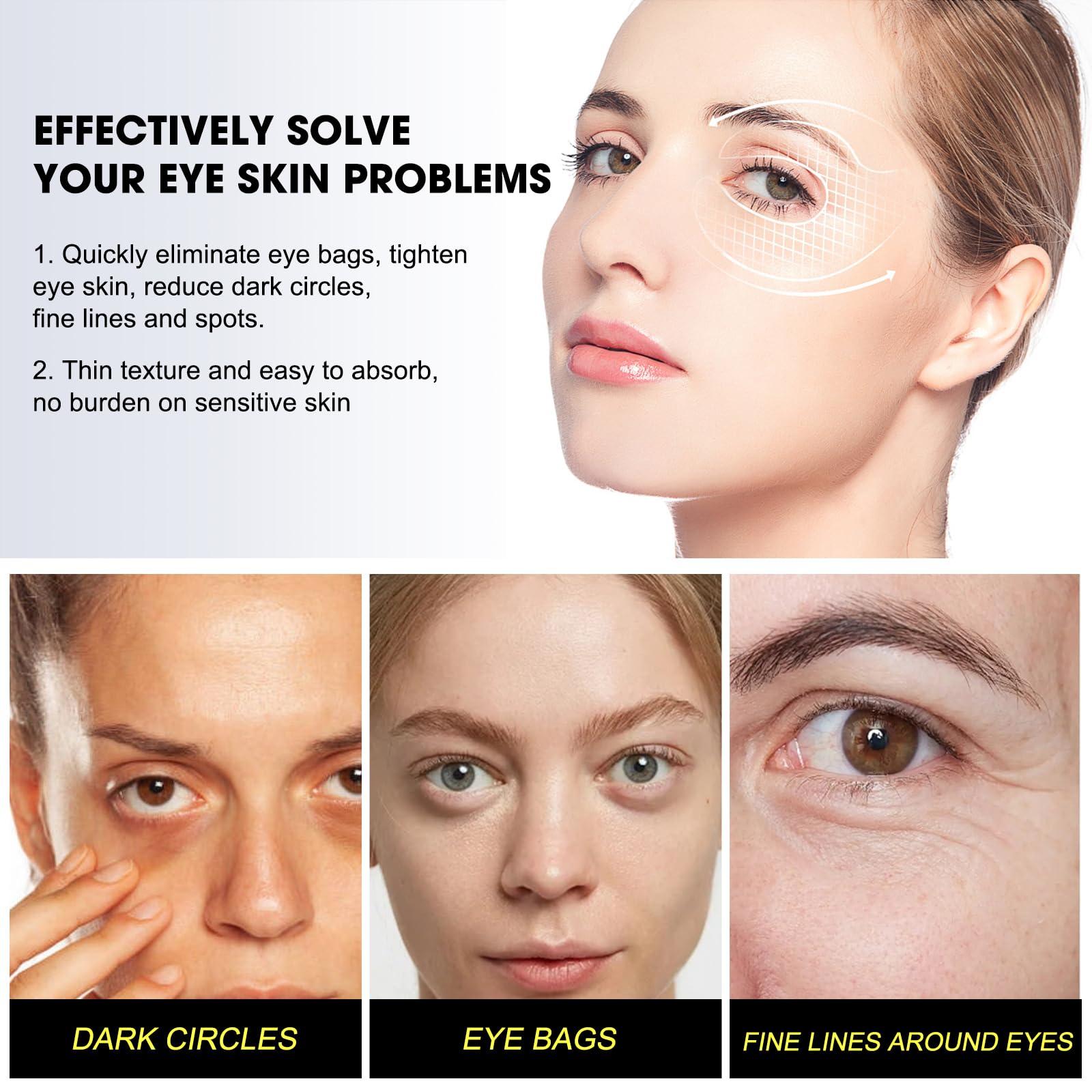 Kubot Harvey Ross Instant Lift Eye Cream, Harvey Ross effective Instant Eye Lift, Multi Action Firming Under Eye Cream, Under Eye Cream for Puffy Eye Bags Fine Lines, Specializes in Lifting The Eye Area