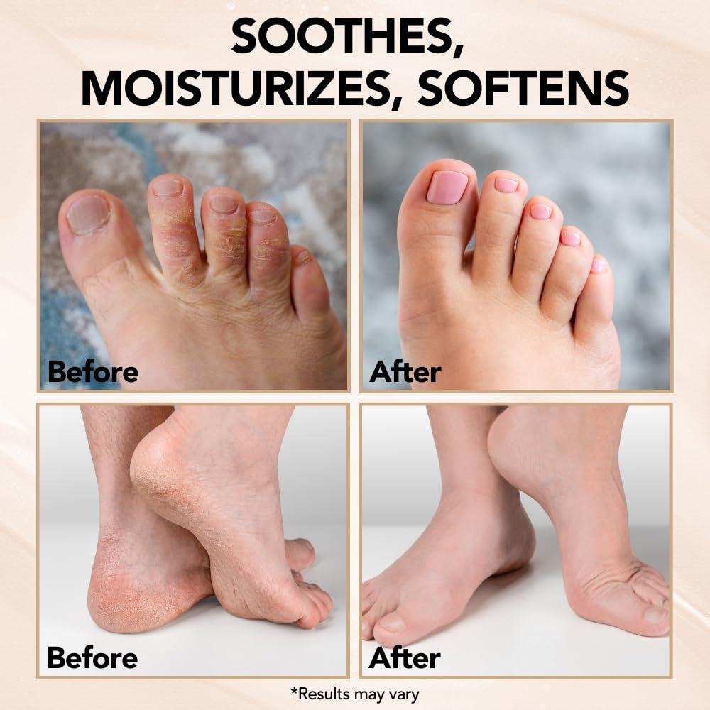 THENA Natural Wellness Athletes Foot Balm Extra Strength Athletes Foot Treatment Cream Heals Dry Cracked Feet Heels Itchy Skin Nails Toenails Advanced Foot Care for Men Women