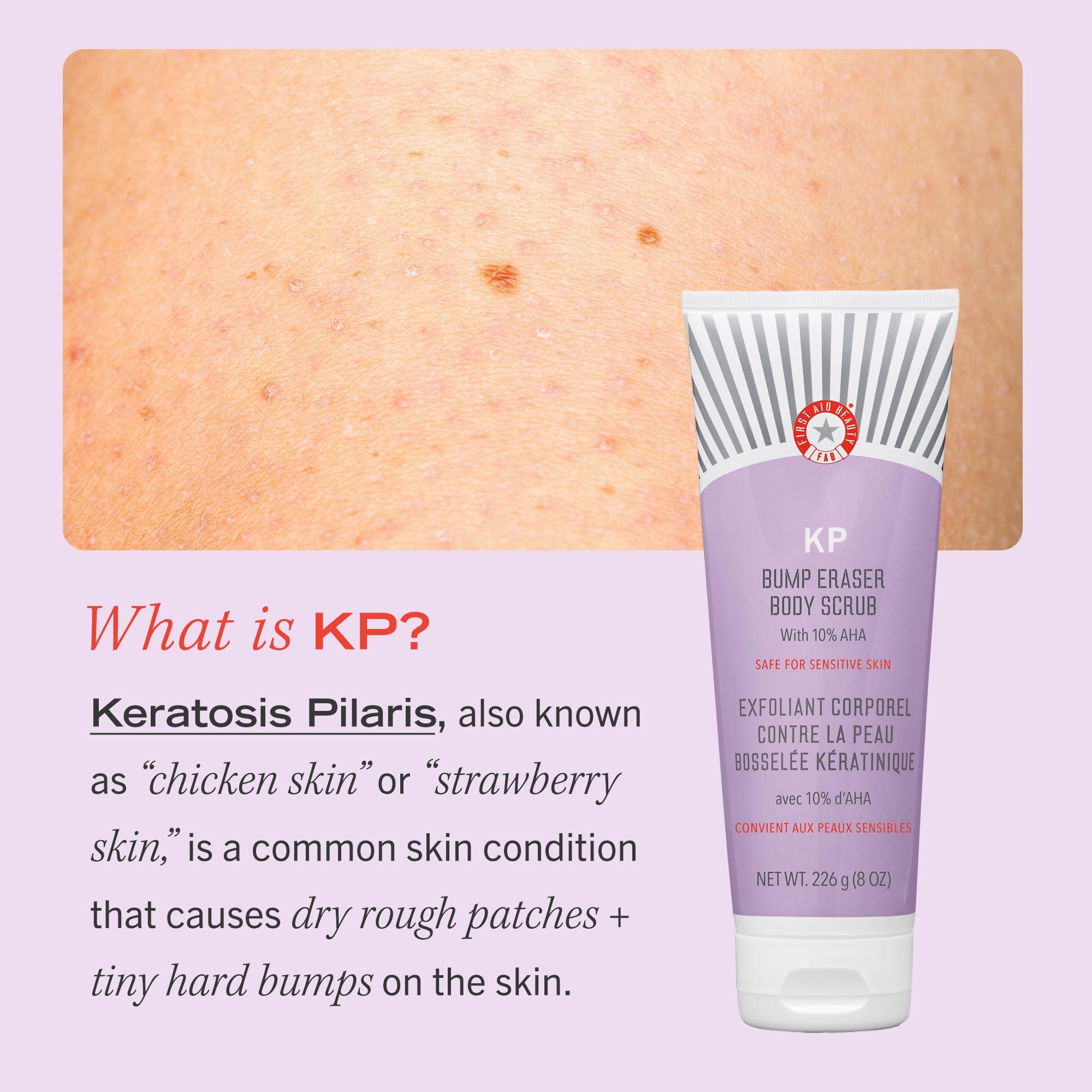 First Aid Beauty First Aid Beauty - KP Bundle: Keratosis Pilaris Bump Eraser Scrub & Smoothing Lotion with 10% AHA, Daily Exfoliating Skin Cleanser to Help Reduce Chicken Skin Bumps, Scrub-8 oz, Lotion-6 oz, 2ct