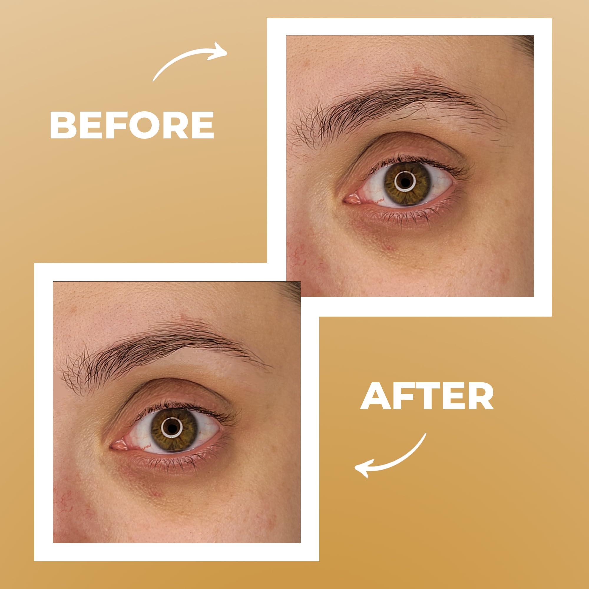 Fab Brows Fab Brows Professional-Grade Tweezers | Stainless Steel Eyebrow Tweezers for Women | Multipurpose Flat Tweezers for Facial Hair, Splinters, Ingrown Hair | Seamless Hair Plucking | Women\'s Grooming