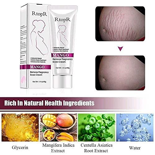 MQUPIN RtopR Mango Stretch Marks and Scar Cream -Stretch Marks and Scar Removal Cream for Pregnancy - Best Body Moisturizer-40g