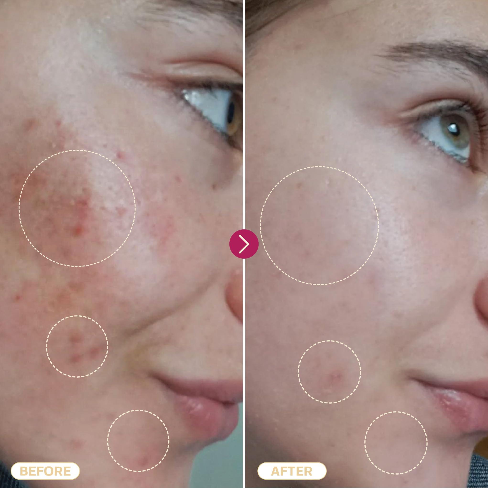 BASE LABORATORIES BASE LABORATORIES Hypochlorous Acid Spray for Face & Skin | 8 oz | Magic Facial Spray Daily Skin Repair Solution for Sensitive Skin, Redness, Irritations, Eczema, Acne. Hypochlrous HOCL Molecule Spray