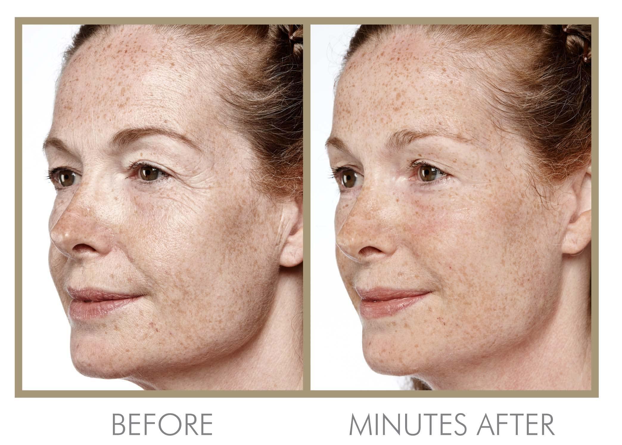 GENIE Beauty Products GENIE Instant Line Smoother (30 ml/1 fl oz)