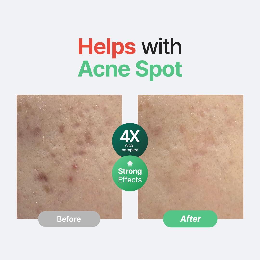 PURITO PURITO Centella Unscented Serum, Korean Centella, for All Skin Types, Ampoule, Soothing, Calming, Facial Serum for face, Vegan & Cruelty-Free, Korean Skin Care, 60ml 2fl.oz