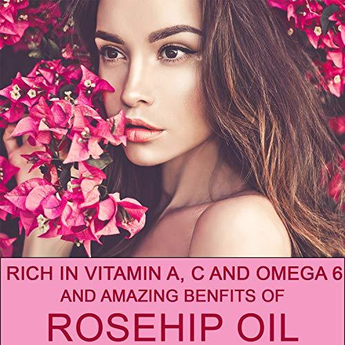 Olivia Care Olivia Care Rosehip Face Oil | Large 2 oz | Packed with Vitamins E, C and A to treat Wrinkles, Acne Scars, Blemishes and Dark Circle– All natural beauty moisturizer for skincare