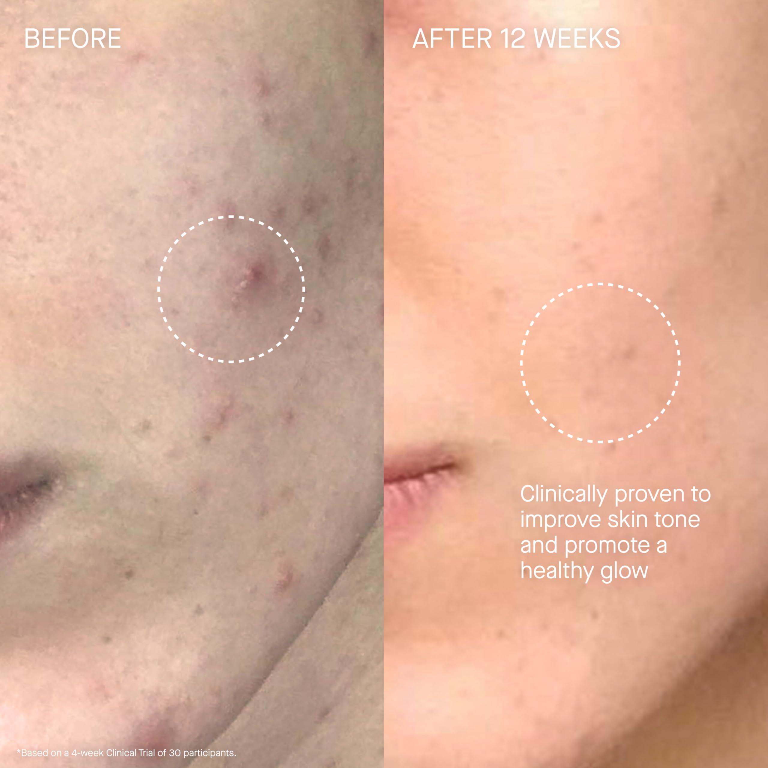 Augustinus Bader Augustinus Bader The Cream 100ml