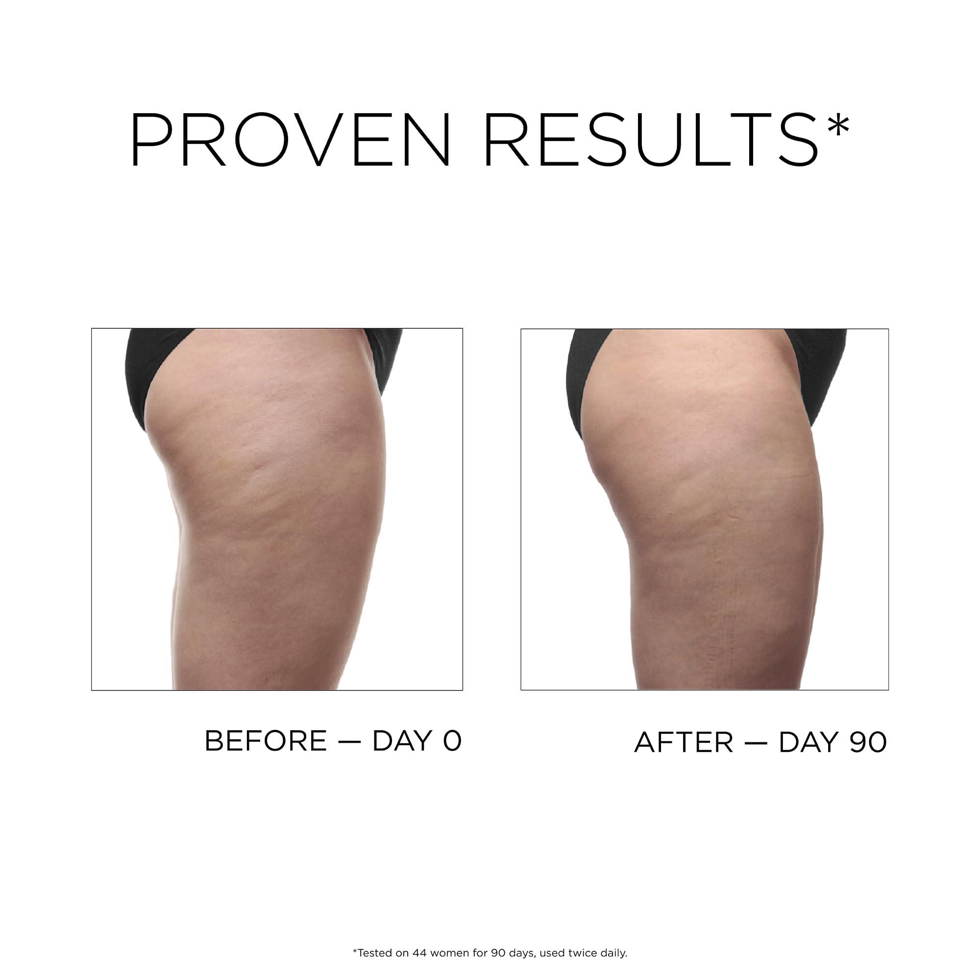 IDC IDC Dermo Profil Celllite Anti Cellulite Body Sculpting Gel - 5 fl oz - Body Firming & Toning Caffeine Gel Cellulite Remover - Vegan Cellulite Treatment for Legs, Stomach, Arms, Thighs & Hips