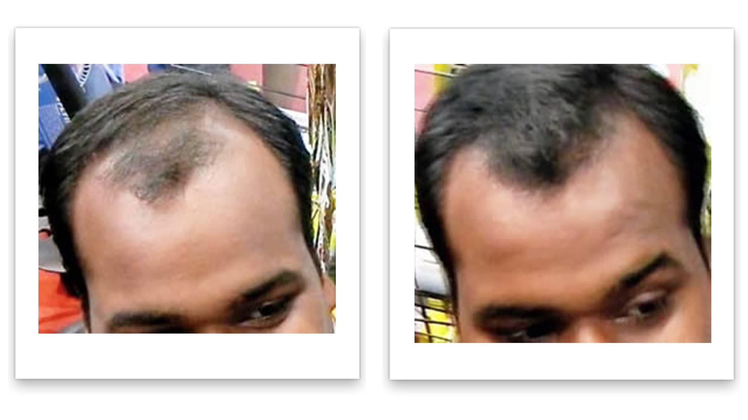 Caboki Caboki All-Natural, Plant-Based Hair Concealer Covers Bald Spot and Thinning Hair. (16G, 40-Day Supply). Black