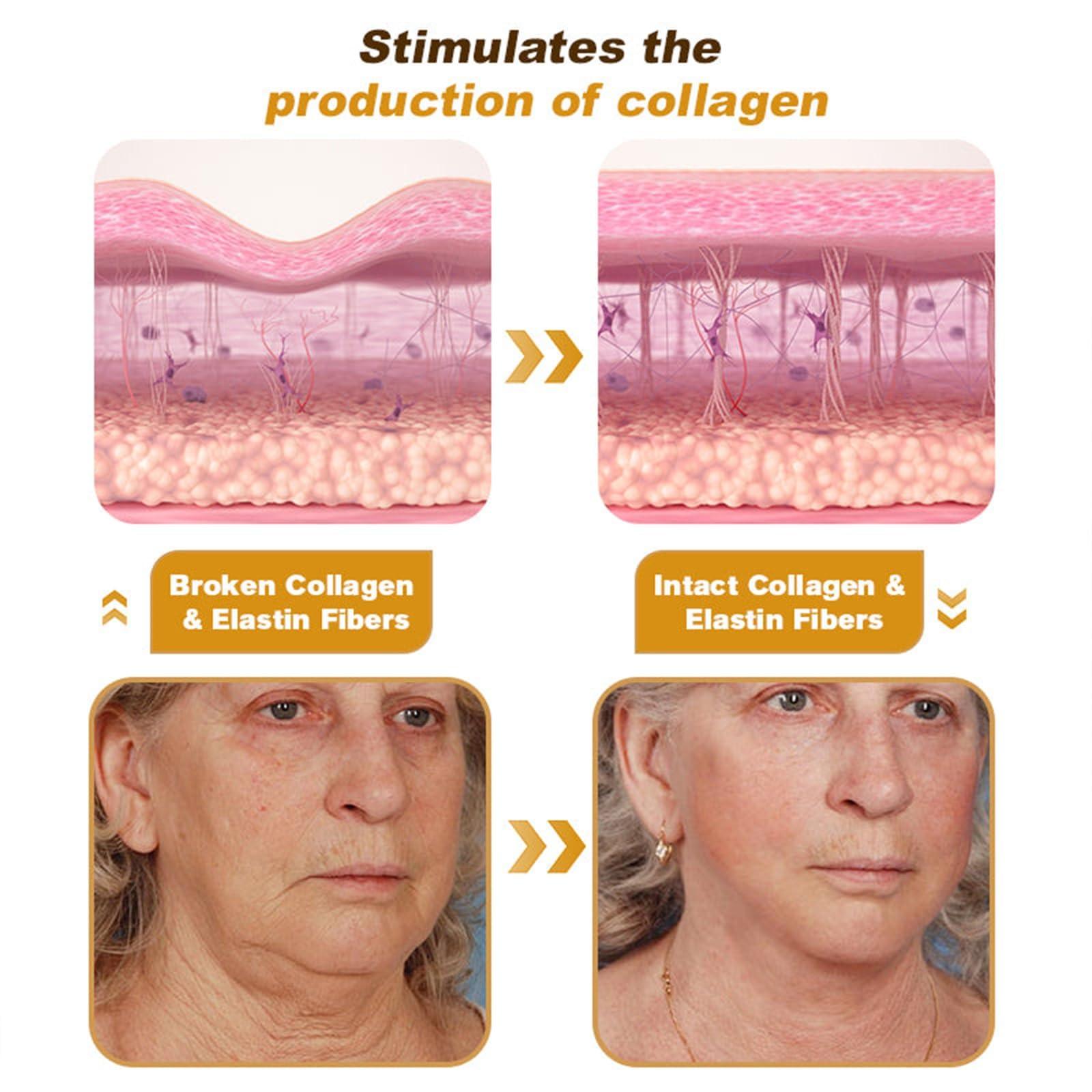 Dyshi New Botox Bee Venom Cream Anti-Wrinkle Firming Multi-Purpose Cream, Upgrade Bee Venom Wrinkle Removal Skin Treatment Cream, Bee Venom Moisturizer Cream for All Skin Types (1)