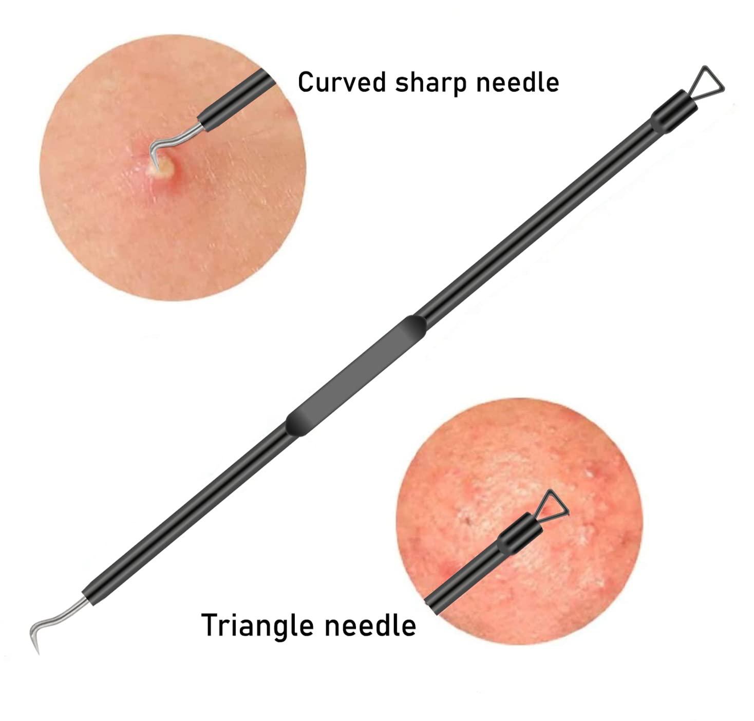 TULOBI Blackhead Remover Pimple Popper Tool Kit 4 Pcs Black Acne Comedone Zit Blackhead Extractor Tool for Nose Face,Stainless Steel Whitehead Popping Removal Tool Set