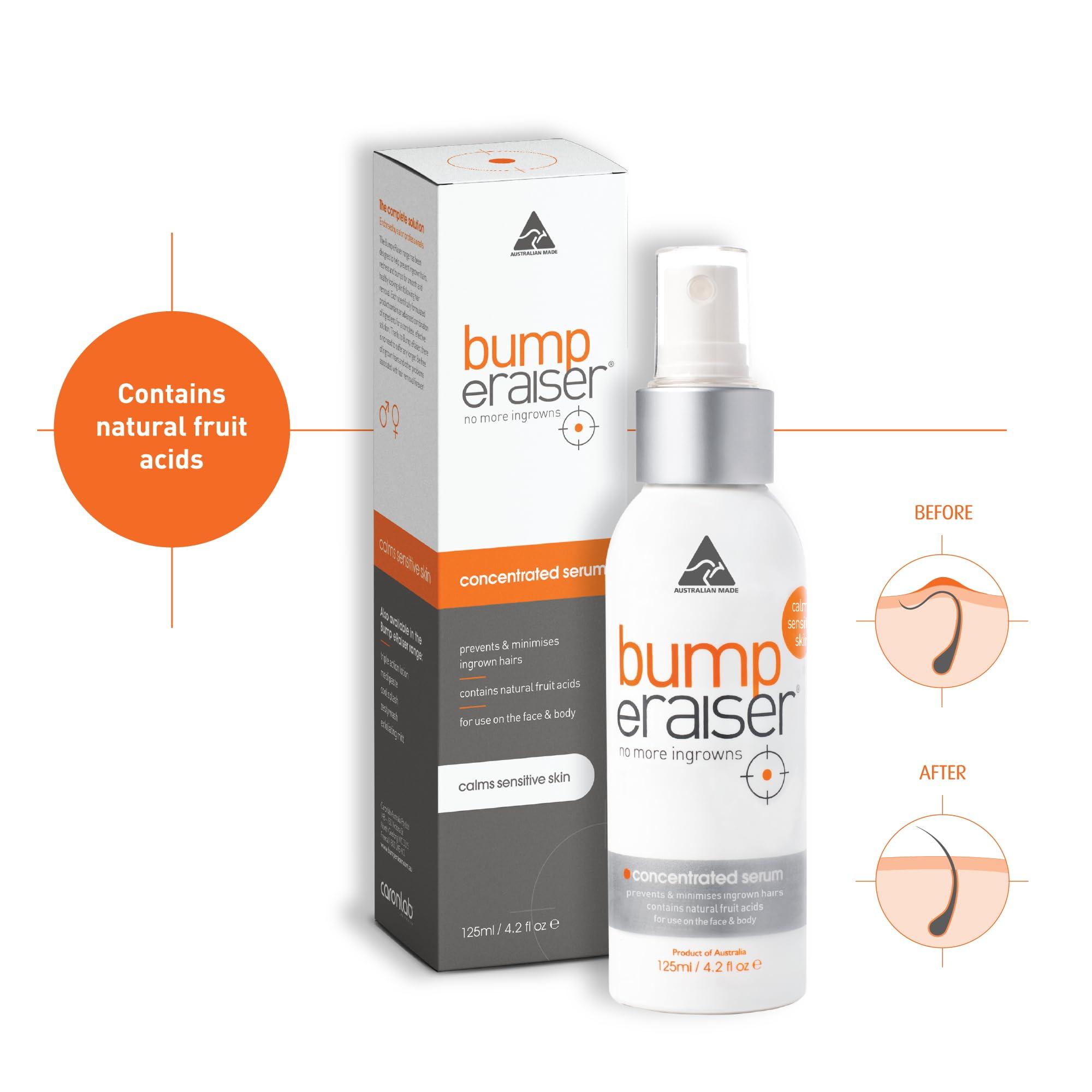 Bump eRaiser Bump Eraiser Concentrated Ingrown Hair Serum 4.2 fl oz for Ingrown Hair Treatment, Razor Burns and Razor Bumps