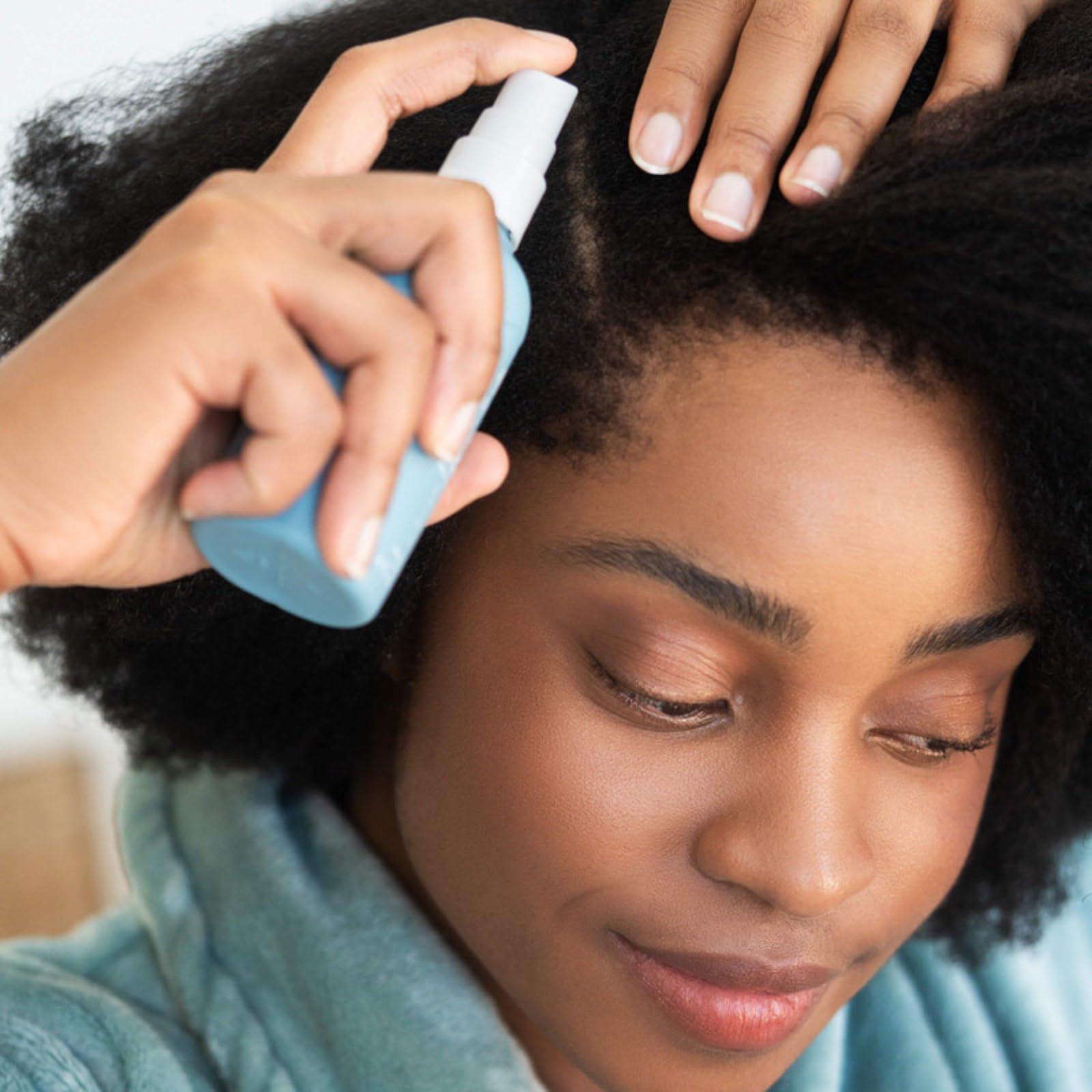 Hairitage Hairitage Dont Wait Up Anti Dandruff Overnight Scalp Relief Scalp Mist - For Dry, Itchy Scalp - Calms Irritated Scalp - Absorbs Quickly - Formulated with Aloe Vera + Peppermint, 4 Fl Oz