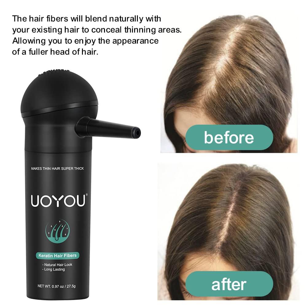 UOYOU BLACK Hair Fibers for Thinning Hair 27.5g Bottle with Applicator | Undetectable & Natural Keratin Hair Fibers Concealer for Hair Loss for Men and Women | Hair Building Fibres Powder [BLACK Hair Fiber]