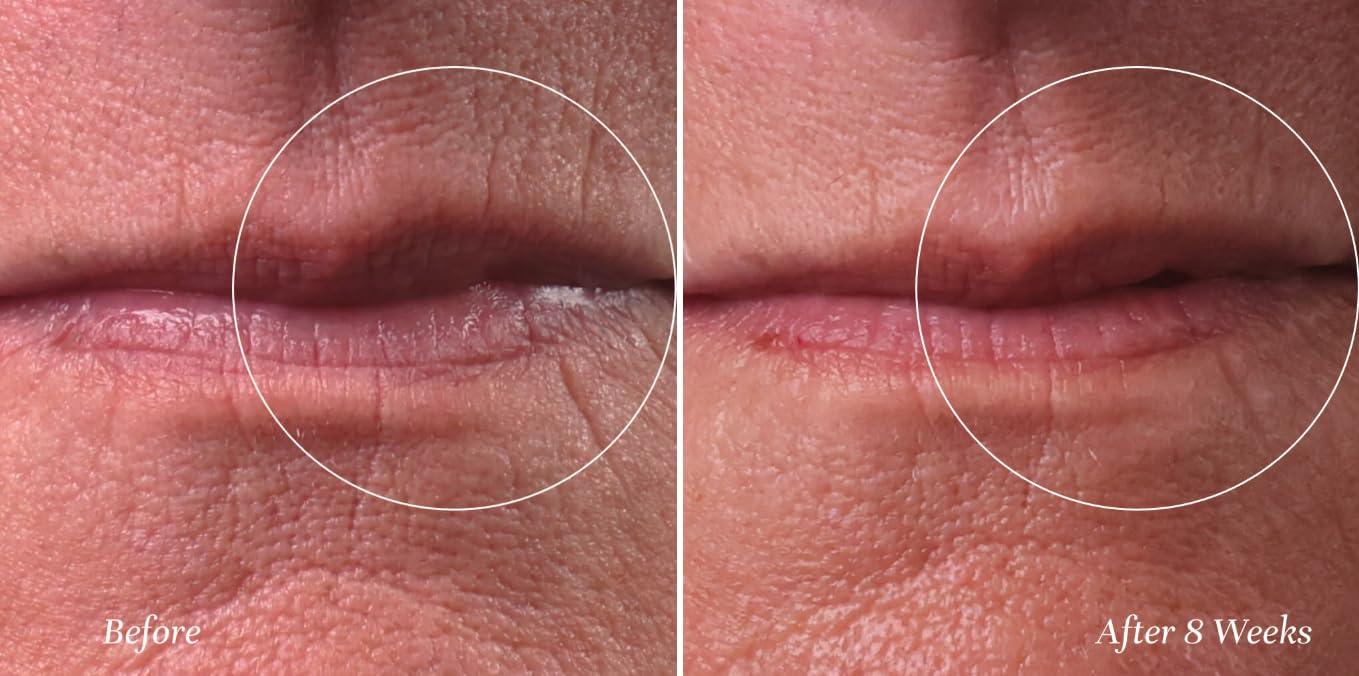 City Beauty City Beauty City Lips Line Therapy - Lip Line Fortifying Treatment - Defining & Smoothing - Solution for Lipstick Lines, Vertical Wrinkles, Corner Creases - Anti-Aging Cruelty-Free Skin Care