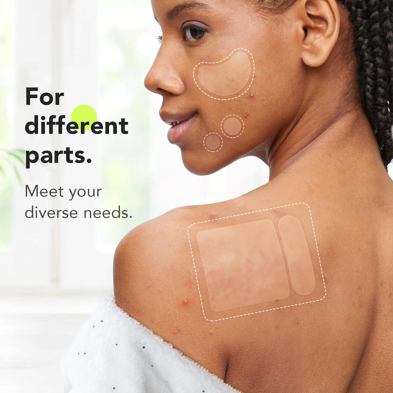 LitBear LitBear Large Pimple Patches (7 Sizes 112 Patches), Big Acne Patches, XL Hydrocolloid Bandages for Full Face, Forehead, Chin, Nose, Body, Back, Neck & Chest, Oval, Moon, Square hydrocolloid Patch