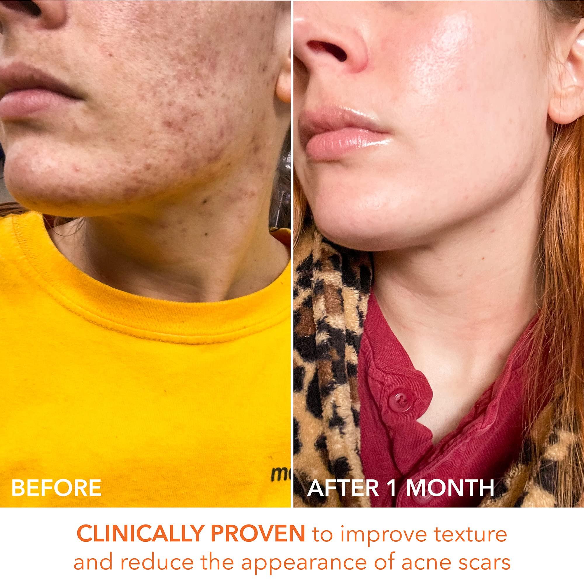 Dr Dennis Gross Alpha Beta Universal Daily Peel by Dr. Dennis Gross for Unisex - 60 Pc Pads