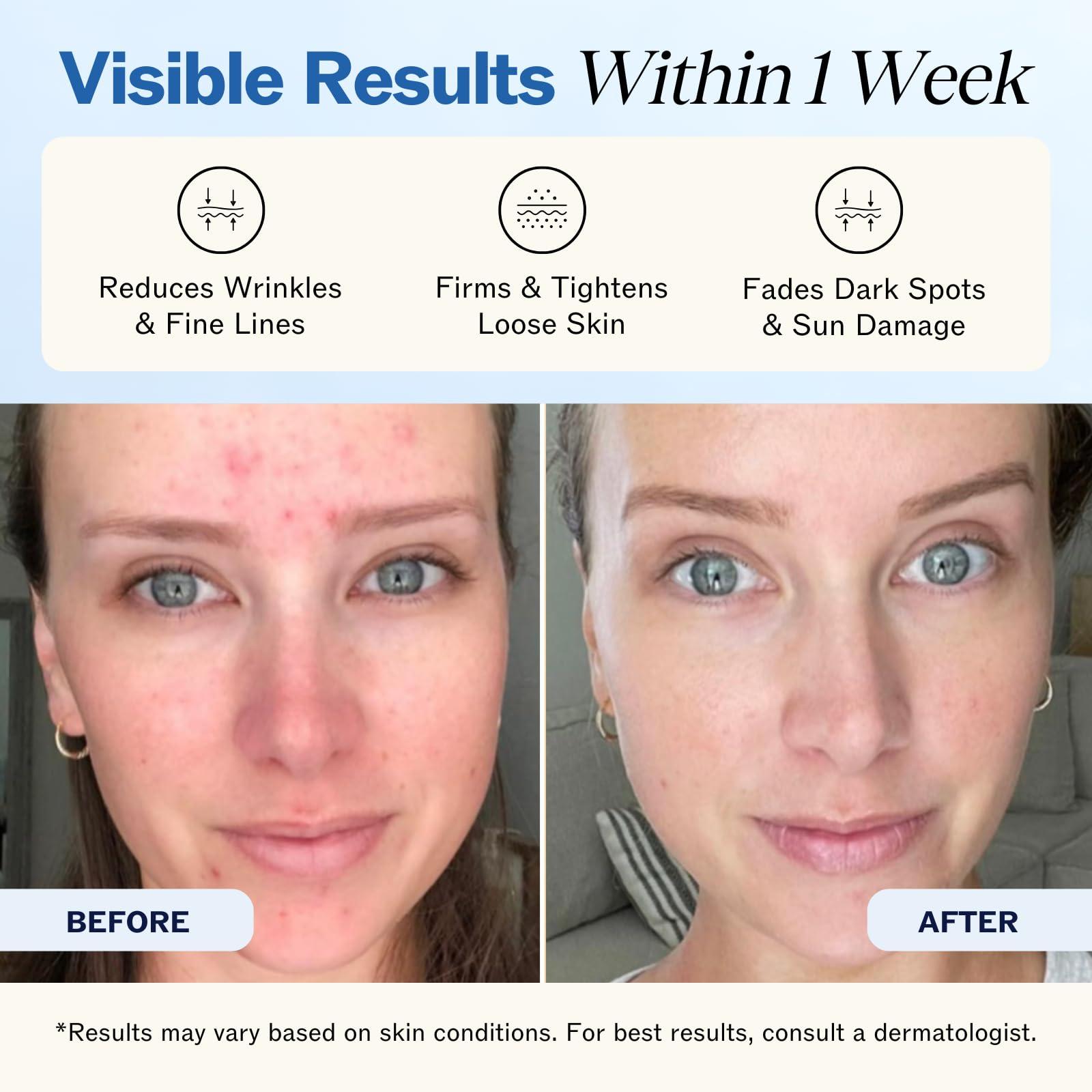 LilyAna Naturals LilyAna Naturals Retinol Cream - Anti-Aging Moisturizer for Face & Neck, Made in USA, Wrinkle Reduction - 1.7oz, 2 Pack