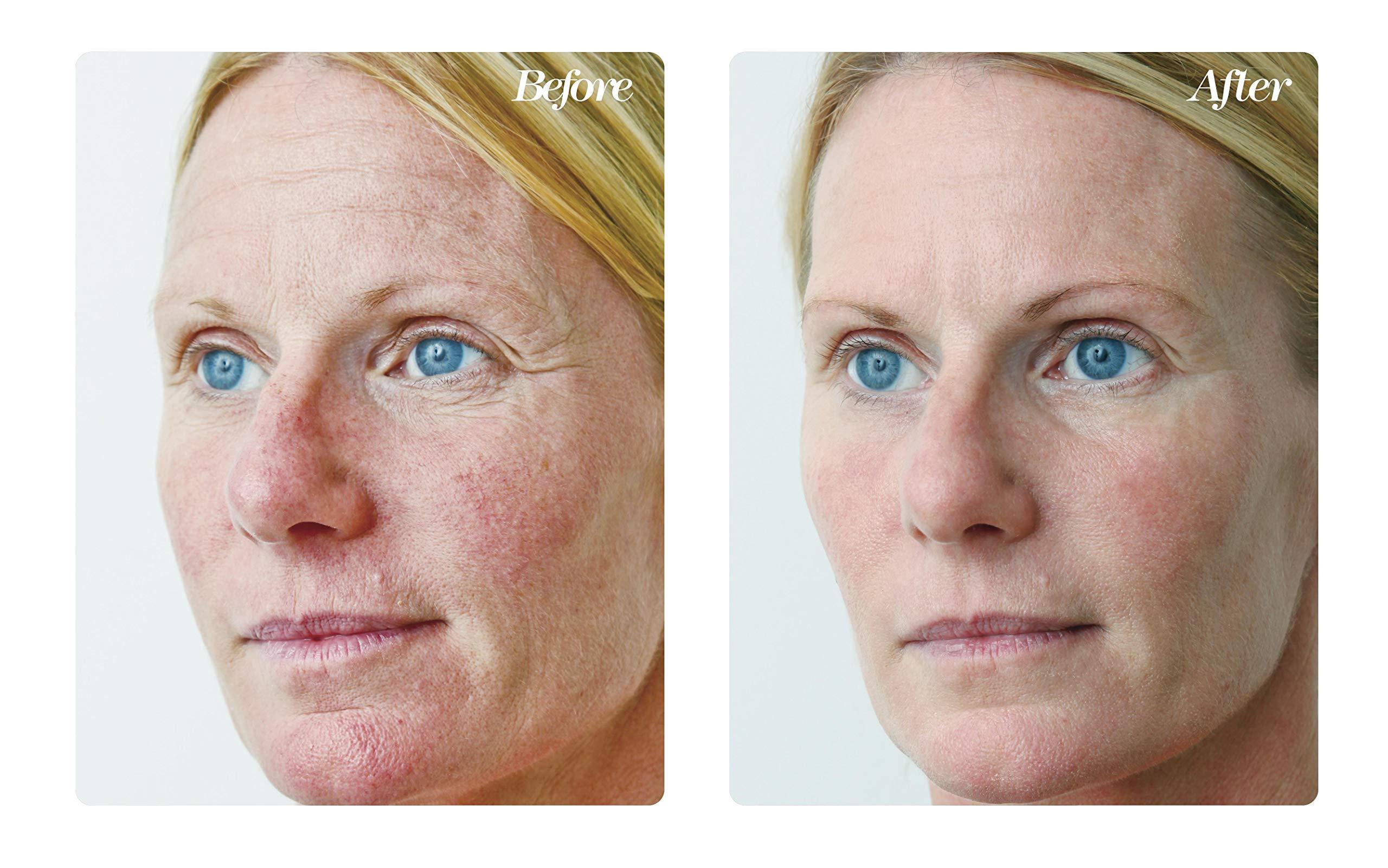 Osmotics Cosmeceuticals Osmotics Blue Copper 5 Firming Elasticity Repair Anti-Aging Cream for Wrinkles, Firmness, and Acne. Visible Results Quickly. Made in the USA