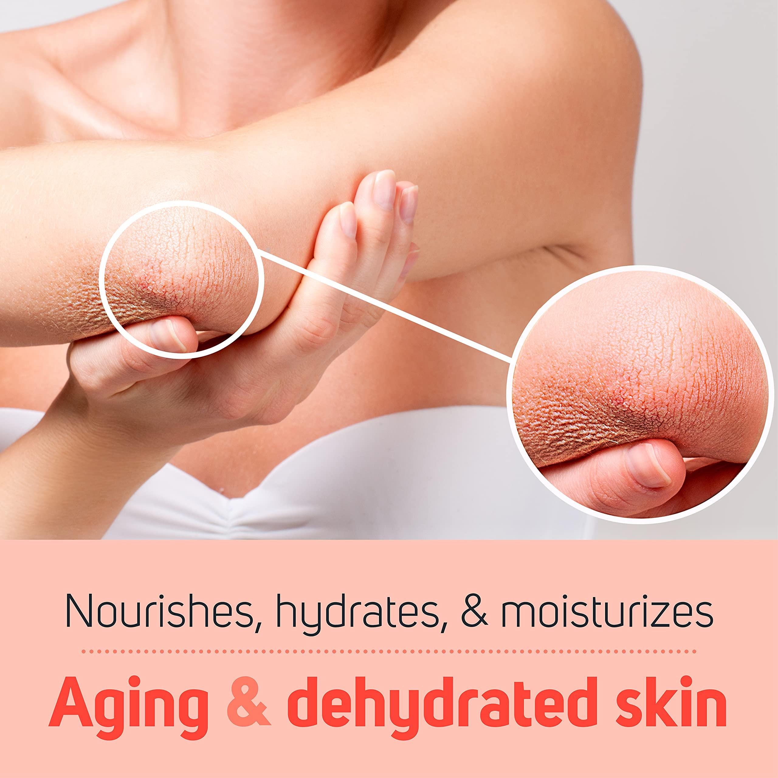 Care Science Care Science Stretch Marks + Scars Skin Care Body Oil, 5 OZ | For C Section Recovery, Scars, Stretch Marks, Hair, Aging, Dehydrated Skin | Natural Ingredients, Vitamin E Oil, Olive Oil, Coconut Oil