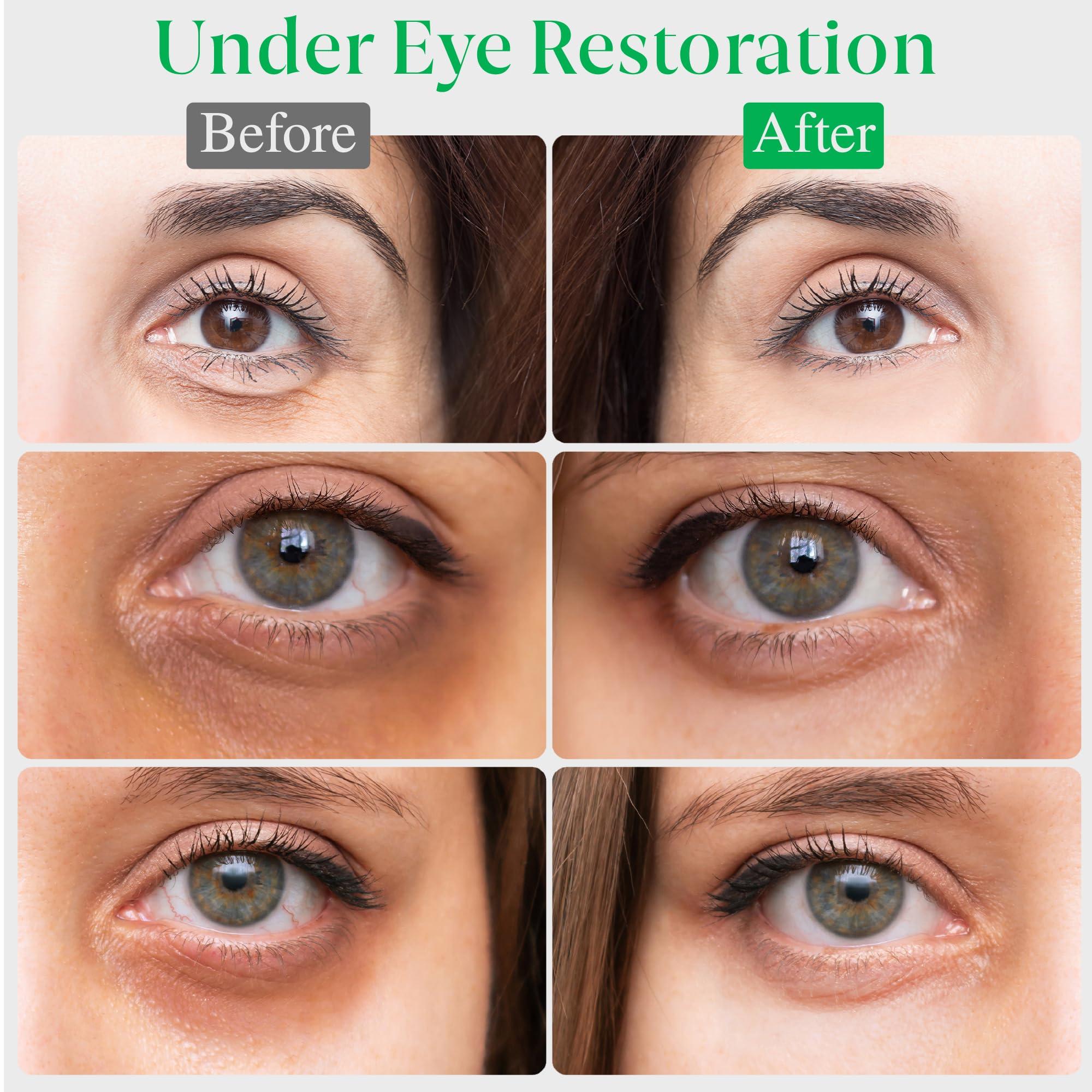 Skinqore Clinicals EyeGLO Caffeine Eye Cream for Dark Circles, Eye Bags, and Puffiness | UnderEye Treatment for Women with Peptides, Antioxidants, Hyaluronic Acid | Natural Brightening EyeCream - 1 Oz