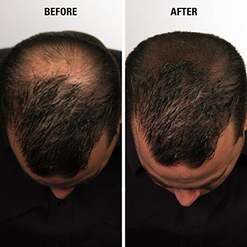 Eclipse Instant Hair Filler ECLIPSE Hair Fibers Dark Brown for Thinning Hair for Women & Men to Conceal Hair Loss in 15 Seconds - 100% Undetectable Hair Building Fibers, 15g