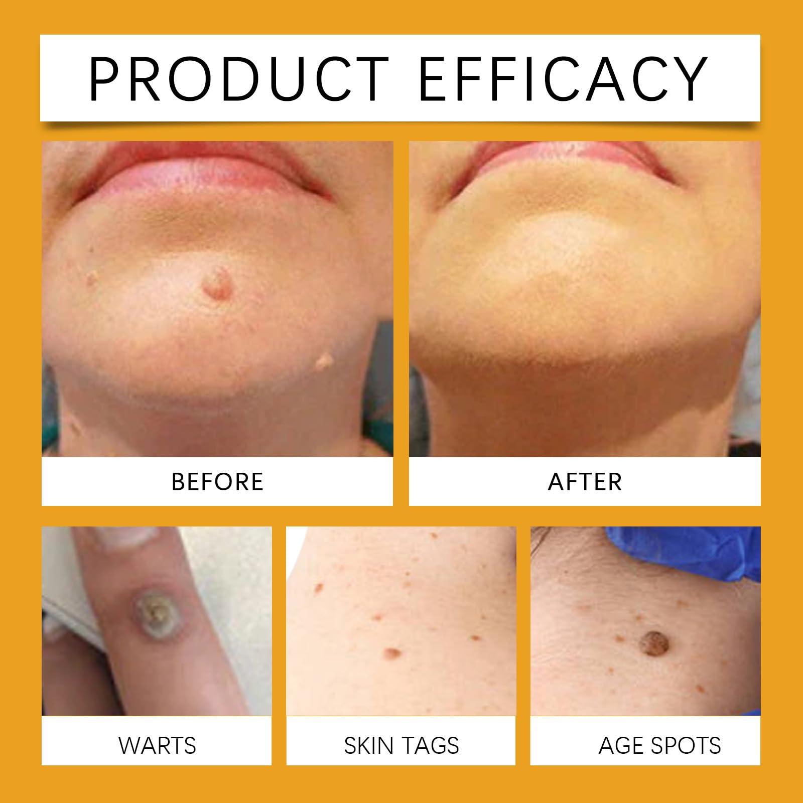 Loobexery 2PCS Bee Venom Repair Cream, Hydrating Moisturizing Cream, Natural Honey Bee Venom Repair Cream Remove Spots for Men&Women, Bee Venom Moisturizing Cream for All Parts of the Body (2*30g)