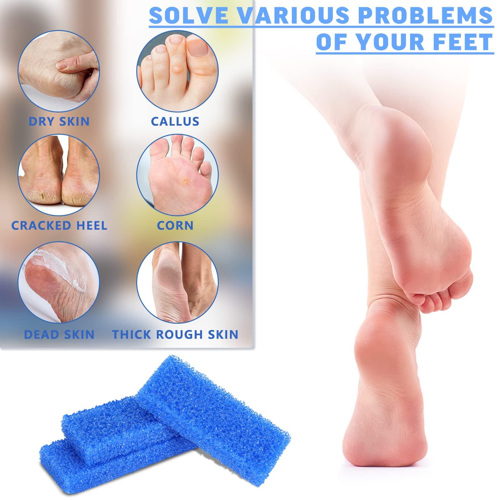 Therwen Therwen 400 Pcs Disposable Pumice Stone for Feet Blue Foot Scrubber Dead Skin Callus Remover for Salon Spa Home