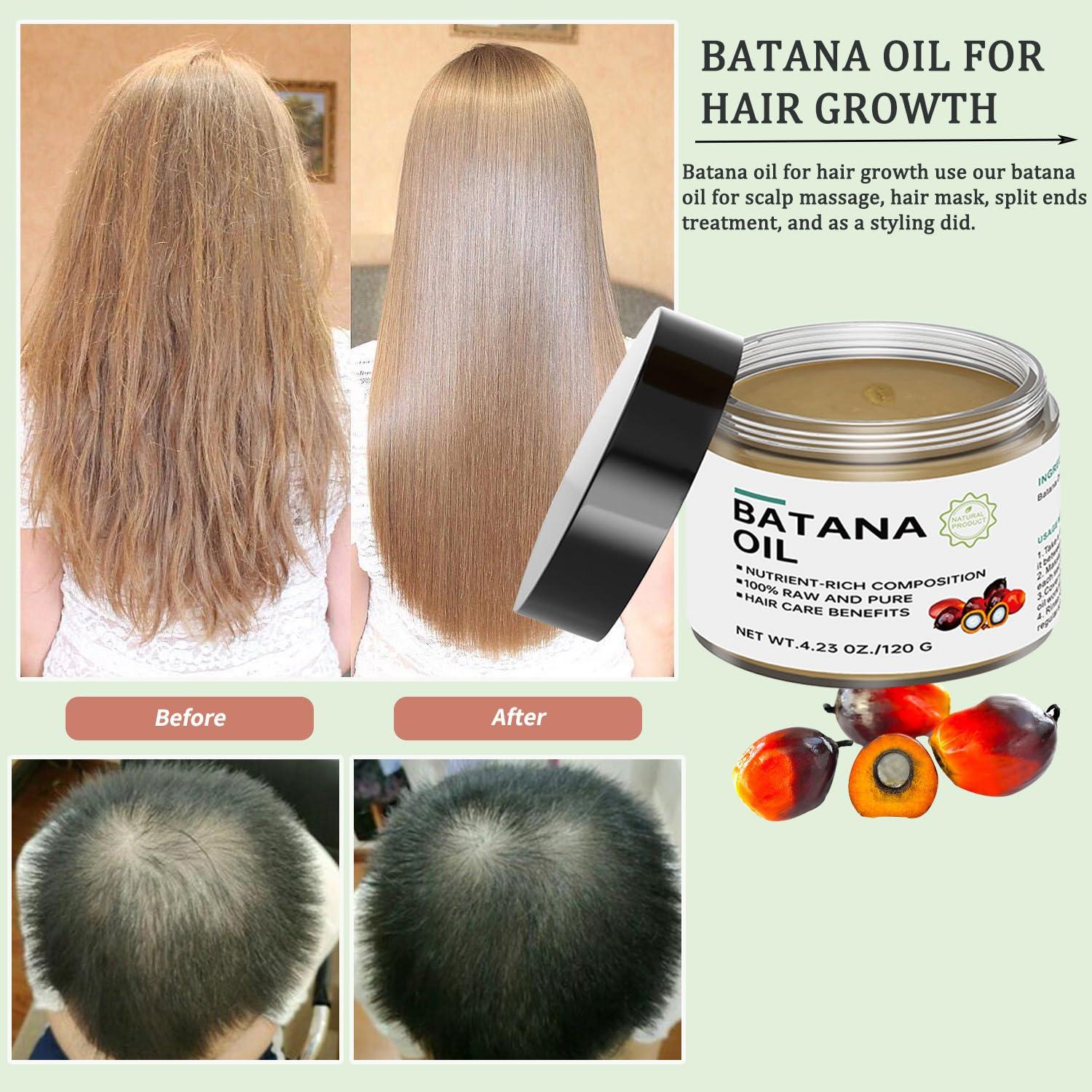 Hywestger Batana Hair Growth Oil - 100% Natural, Organic, Honduran Source - Prevents Loss, Moisturizes Scalp, Restores Dry Hair - 4.23 OZ