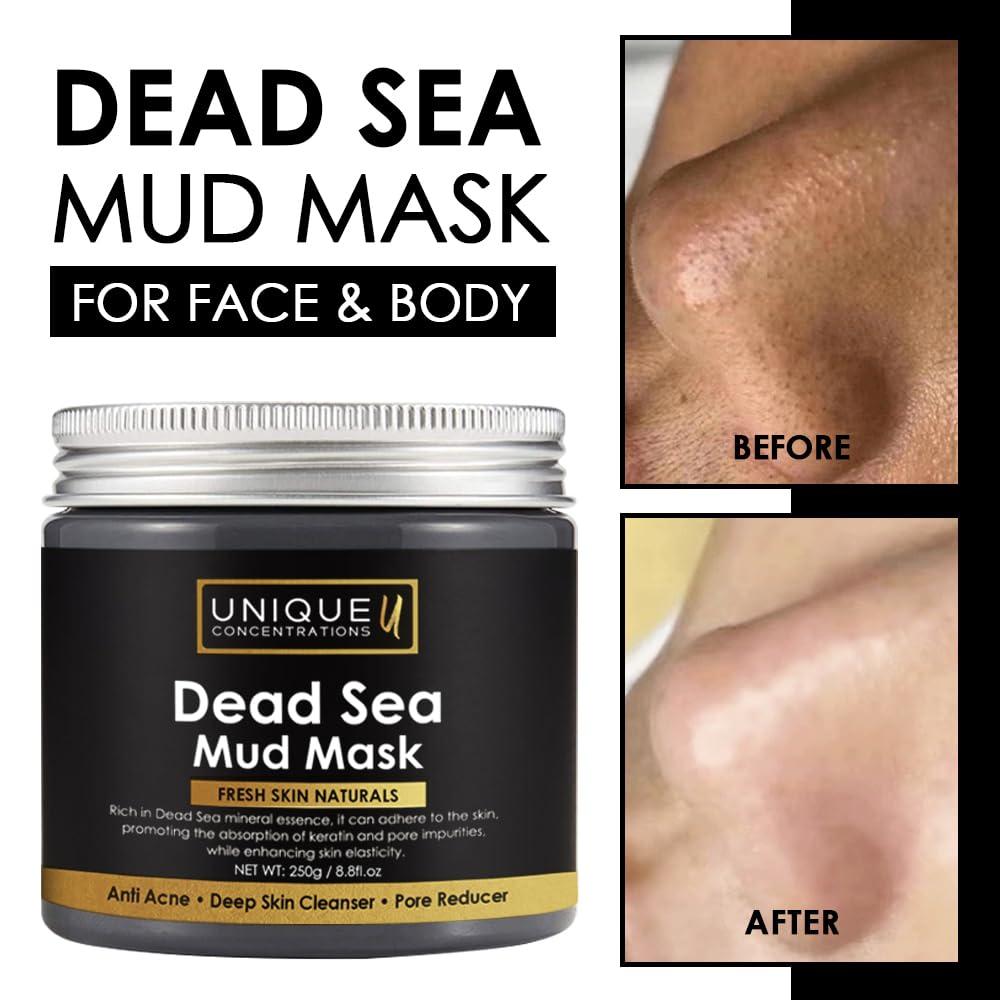 UNIQUE CONCENTRATIONS Dead Sea Mud Mask for Face and Body - Deep Cleansing, Exfoliating, Detoxifying for Acne, Blackheads, Oily Skin, and Pore Clearing - 100% Natural Mineral-Rich Formula for Men and Women - 8.8 oz