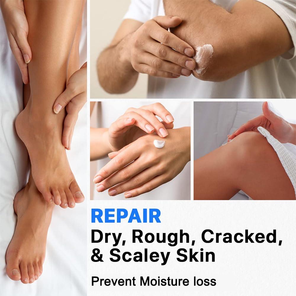 resdam Urea Cream 40%, Keratolytic Foot Cream for Dry Cracked Heels, Feet, Knees, Elbows, Hands, Cuticle, Callus Remover, Skin Barrier Repair (2)