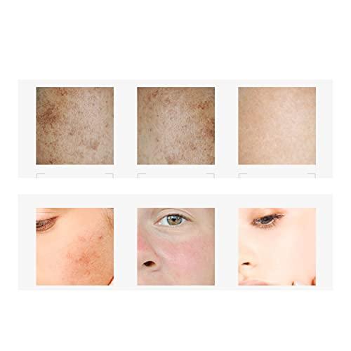 CHONGTAI 1 PC Isana Pigment Flecken 2 in 1, Vitamin C Freckle and Darkness Removal Serum, Removing Darkness and Pimple Spots Around Mouth, Get A Clear Transparent and Even Complexion, 50ml.