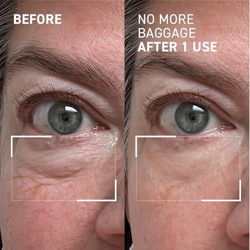 Dr. Brandt Skincare Dr. Brandt Skincare Needles No More Baggage Eye Gel Unisex, Nude, 0.5 Oz