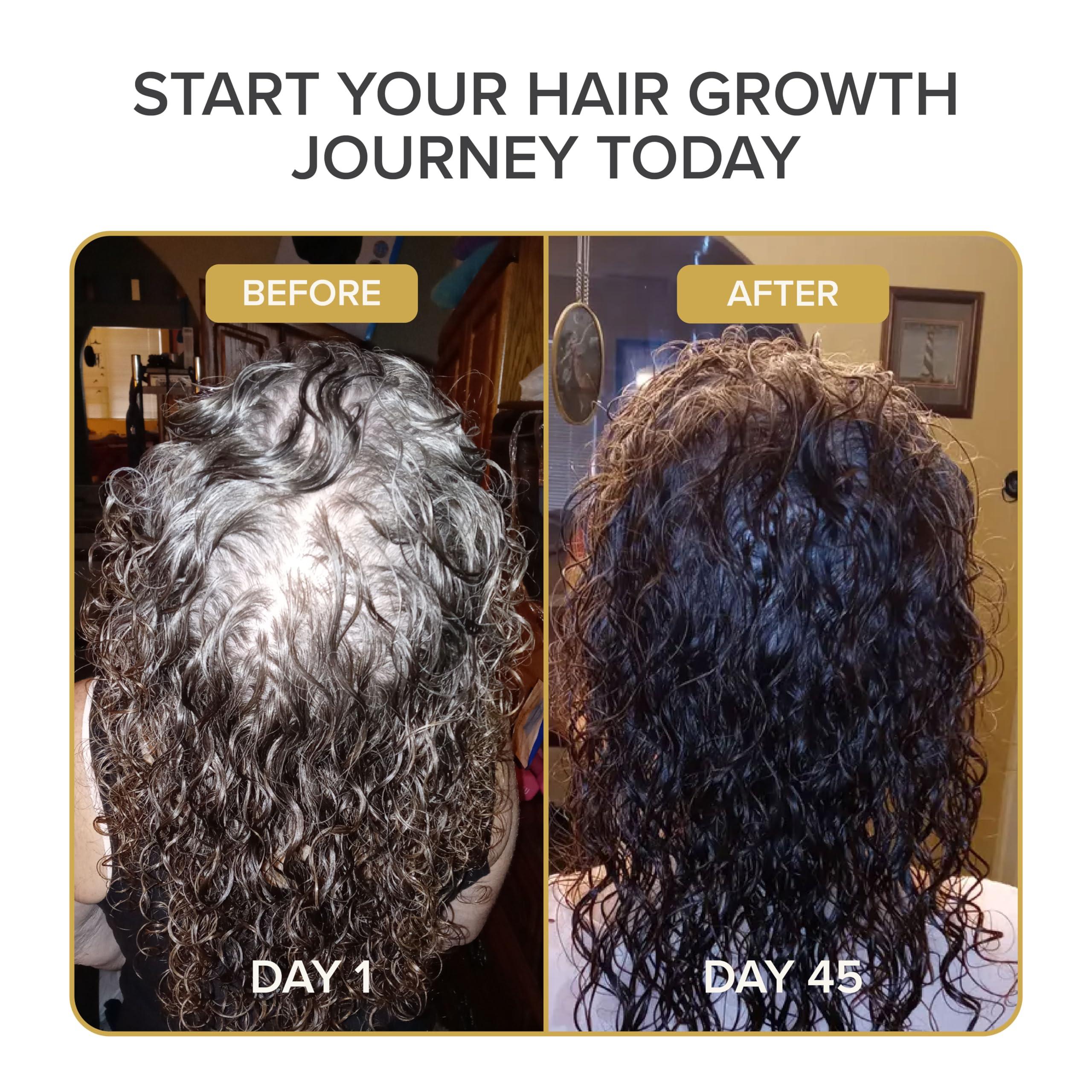 Shedavi Shedavi Iconic Vegan Hair Serum with Botanicals - Growth Treatment for Women & Men\'s Dry, Damaged Hair and Scalp with Argan, Coconut, Castor, and Tea Tree Oils