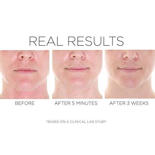 COSMEDIX COSMEDIX CPR Skin Recovery Face Serum for Skin Care - Soothe & Protect Sensitive, Dry Skin - Redness Relief for Face - Hydrating Serum for Facial Care - With Peptides, Rhodiola, Arnica Montana