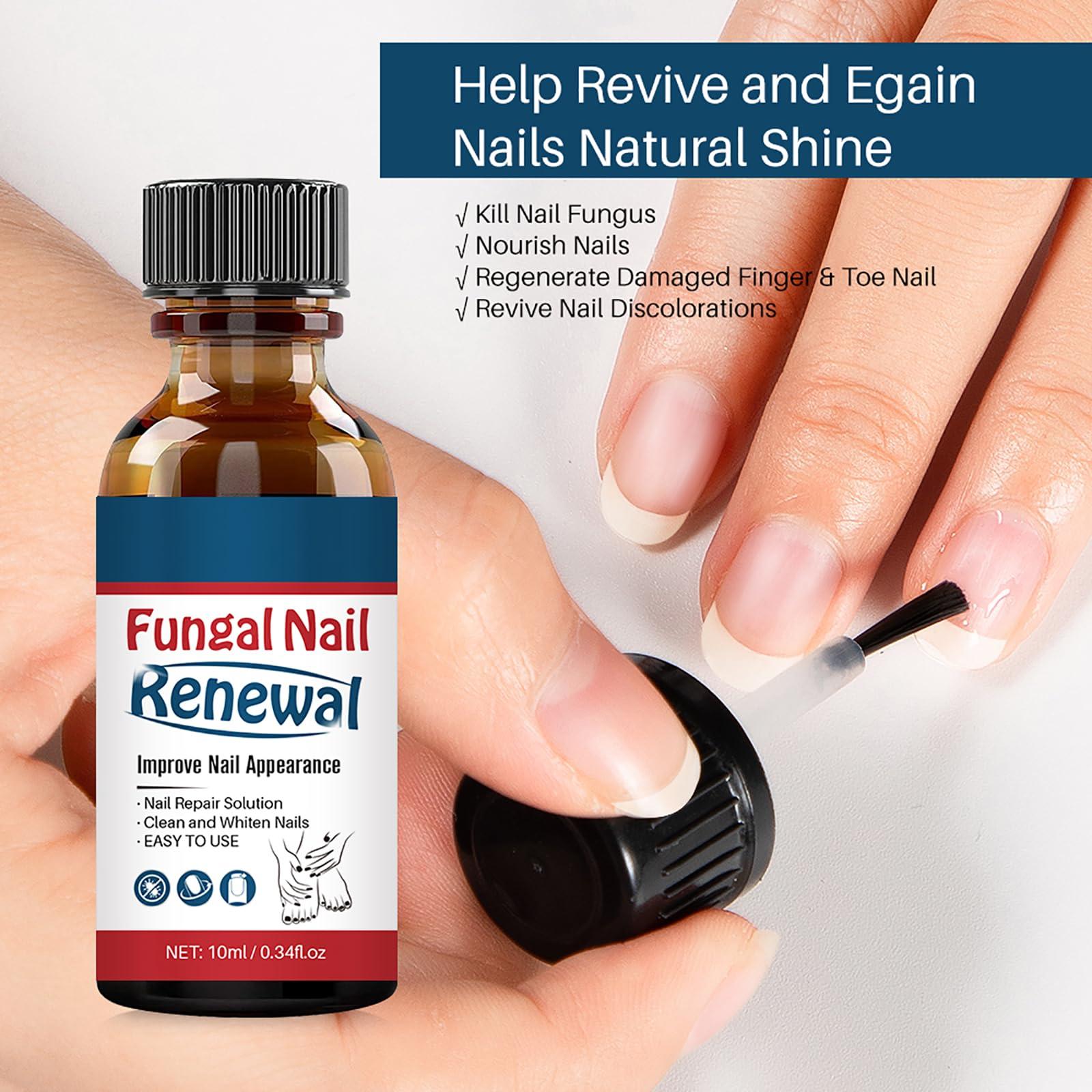 Easilydays Easilydays Nail Repair Essnce Liquid, Fingernail and Toenail Repair, Fix & Renew Damaged, Broken, Cracked & Discolored Nails, Reduce Nail Thickening, Strengthen Nails for Beautiful Nail