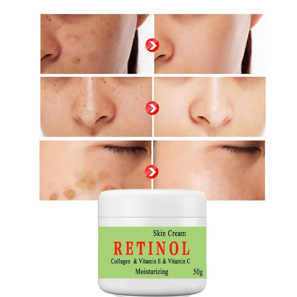 BEROZA BEROZA Cremas Para Las Manchas de La Cara, 50g Vitamin C&E Face Moisturizer Cream, Adecuado para varias reas como cara, axilas, cuello, zona privade (3pcs)