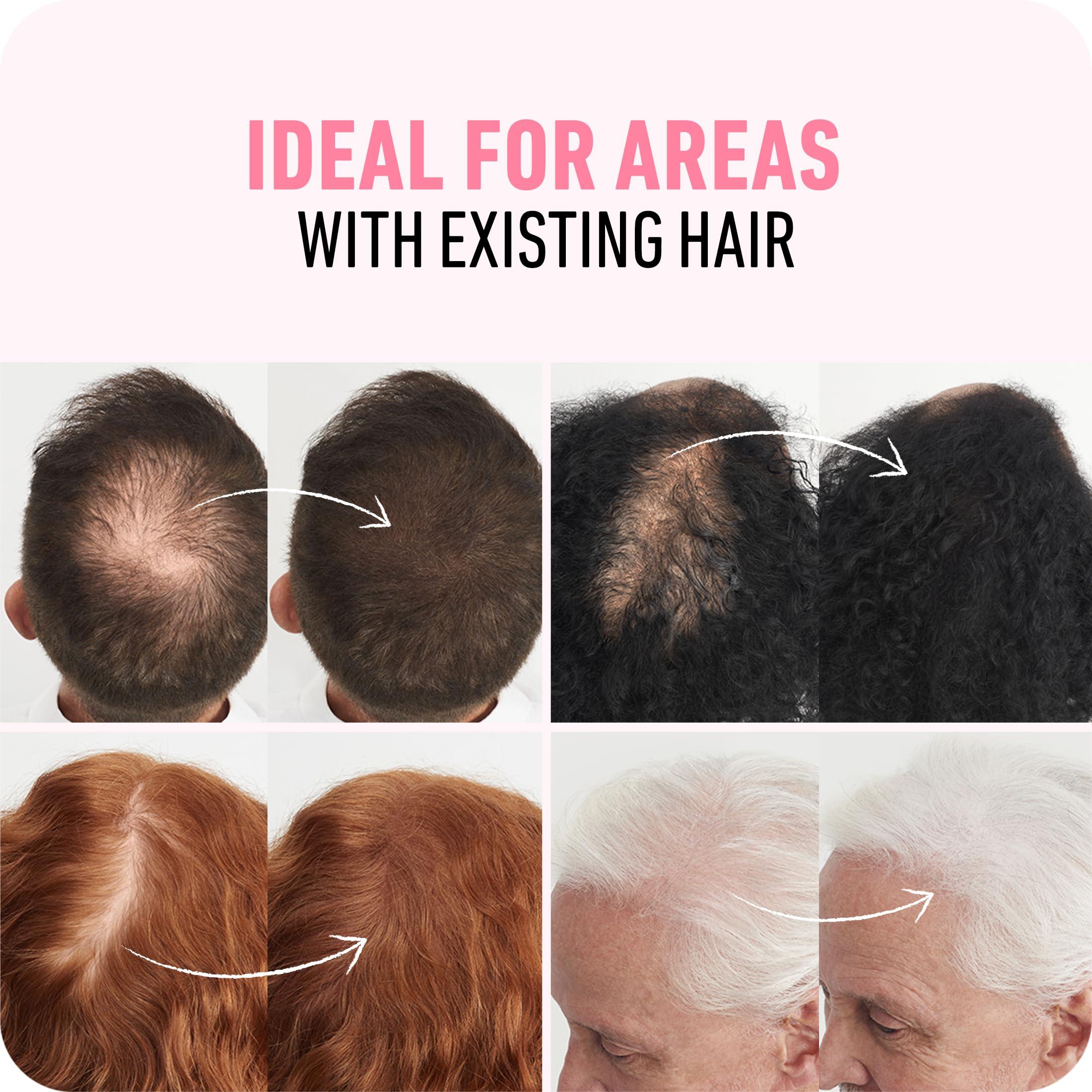 Boldify BOLDIFY Hair Fibers (56g) - Fill In Thinning and Fine Hair for an Instantly Fuller, Thicker Look - 14 Shades for Women & Men - Hazel Brown